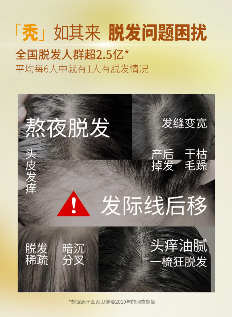 宝丝捷防脱固发洗发水---750X1024详情页2.jpg